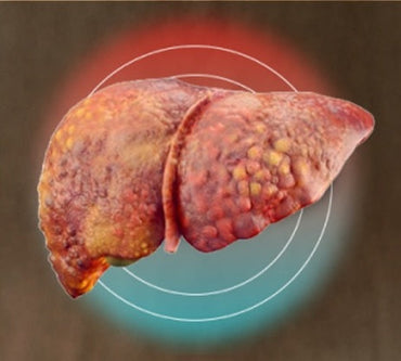 From Air Toxins to Liver Toxins: How Our Polluted Atmosphere Harms Your Liver